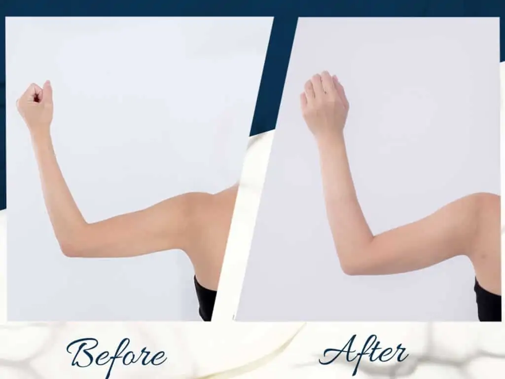 ดูดไขมัน เติมไขมัน Amara Liposuction Center (เอมาร่า คลินิก) โดยแพทย์ผู้มีประสบการณ์