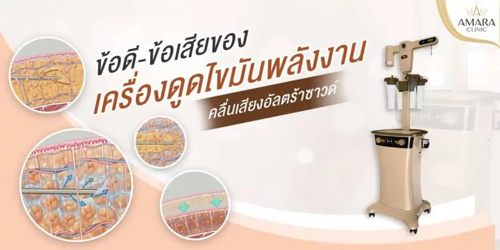 ดูดไขมัน เติมไขมัน Amara Liposuction Center (เอมาร่า คลินิก) โดยแพทย์ผู้มีประสบการณ์