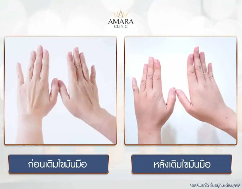 ดูดไขมัน เติมไขมัน Amara Liposuction Center (เอมาร่า คลินิก) โดยแพทย์ผู้มีประสบการณ์