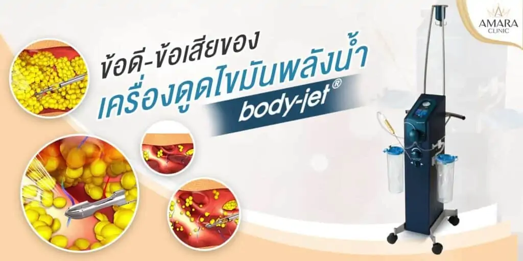 ดูดไขมัน เติมไขมัน Amara Liposuction Center (เอมาร่า คลินิก) โดยแพทย์ผู้มีประสบการณ์
