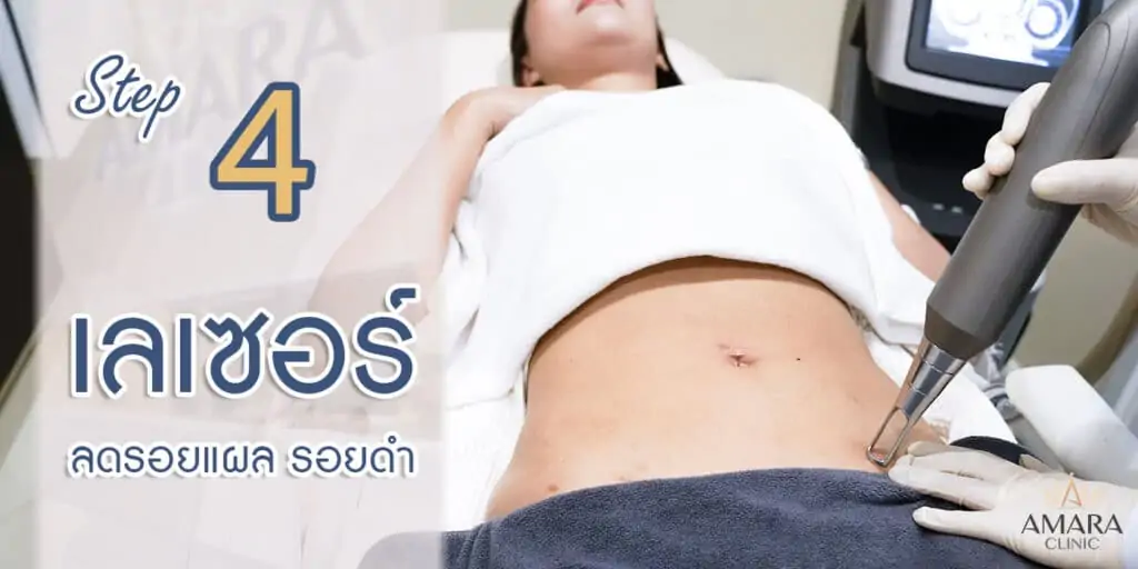 ดูดไขมัน เติมไขมัน Amara Liposuction Center (เอมาร่า คลินิก) โดยแพทย์ผู้มีประสบการณ์