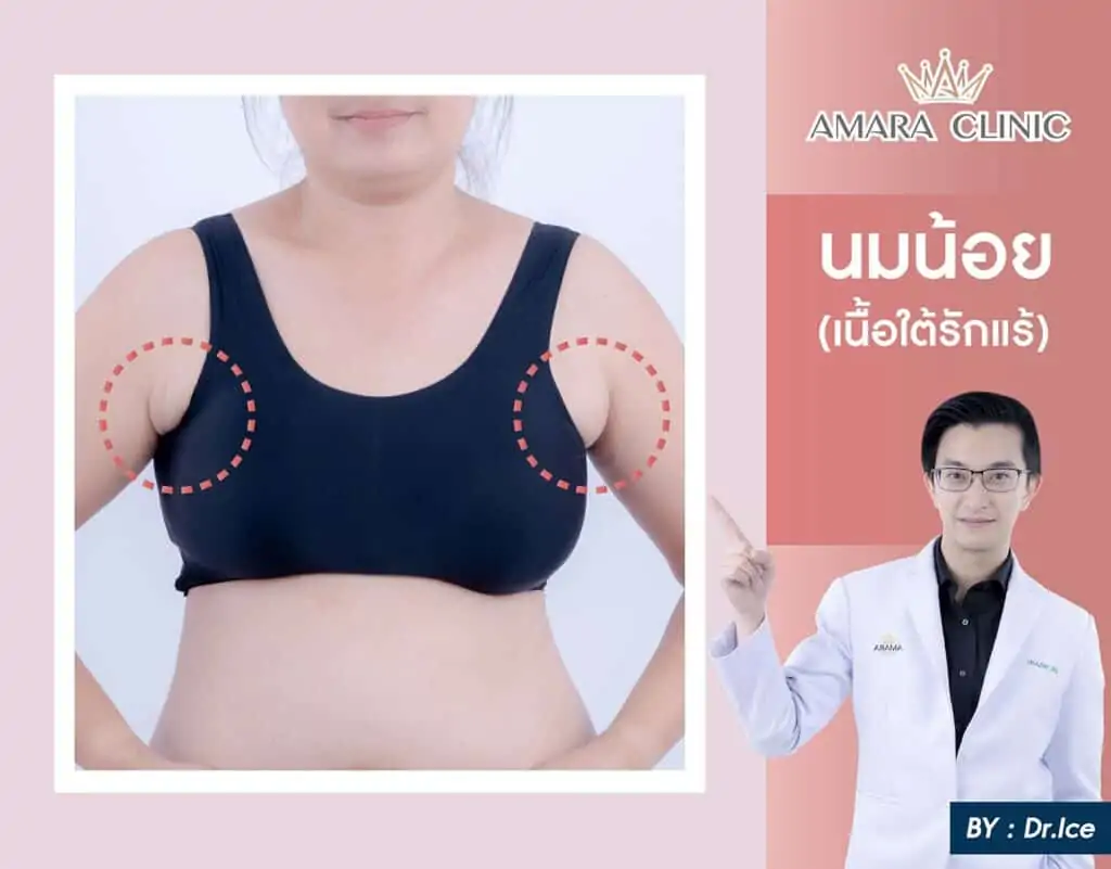 ดูดไขมัน เติมไขมัน Amara Liposuction Center (เอมาร่า คลินิก) โดยแพทย์ผู้มีประสบการณ์