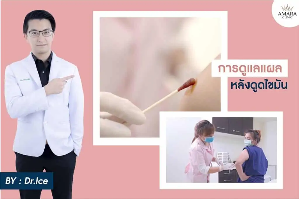 ดูดไขมัน เติมไขมัน Amara Liposuction Center (เอมาร่า คลินิก) โดยแพทย์ผู้มีประสบการณ์