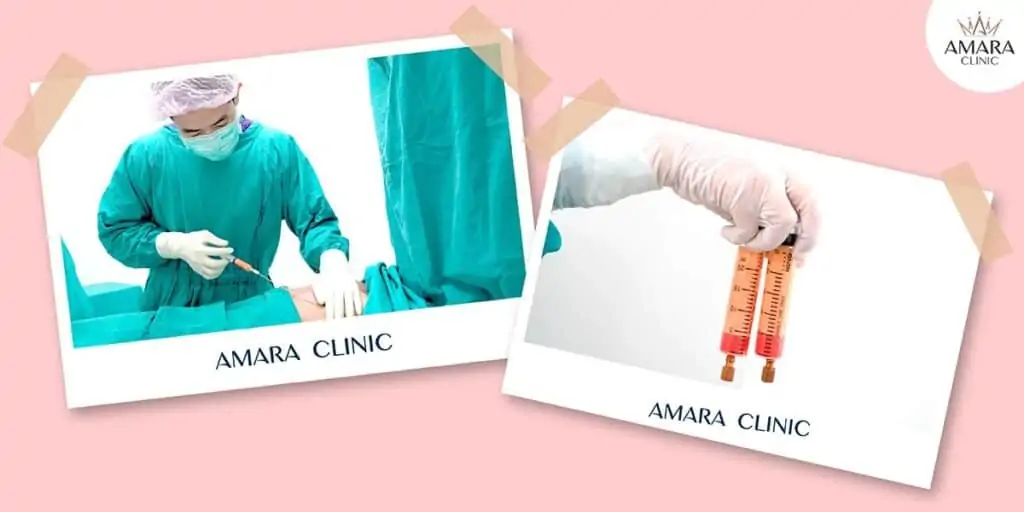 ดูดไขมัน เติมไขมัน Amara Liposuction Center (เอมาร่า คลินิก) โดยแพทย์ผู้มีประสบการณ์