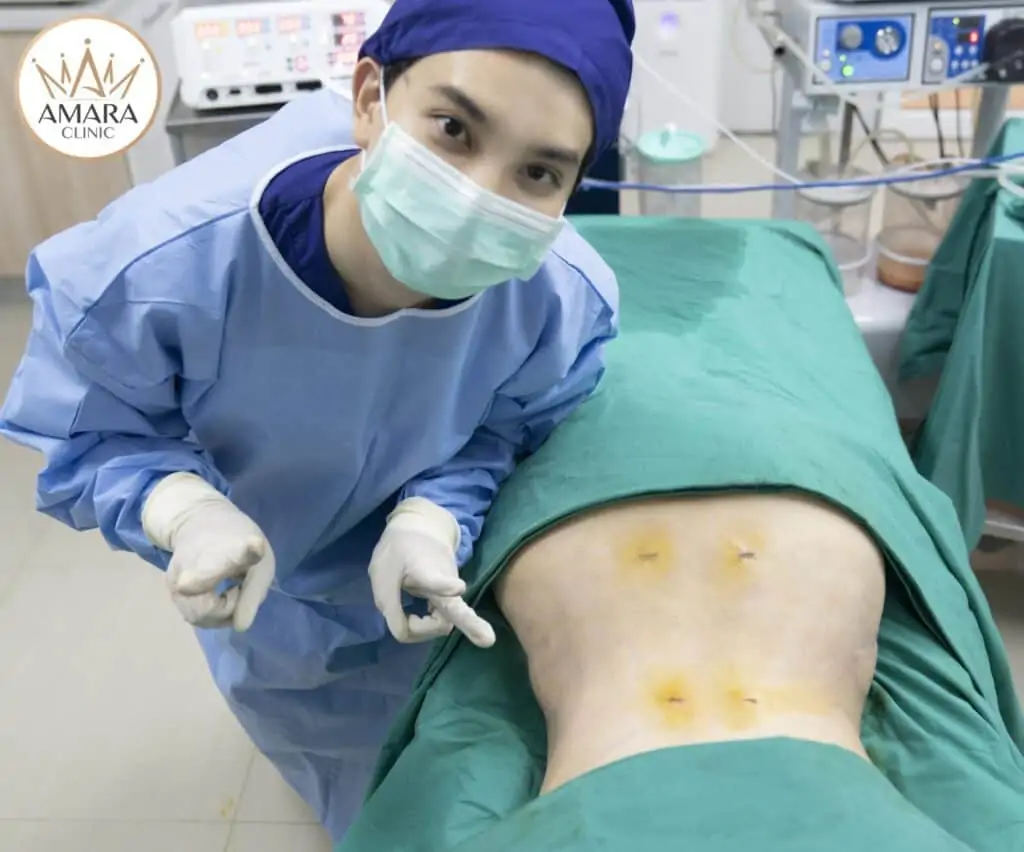 ดูดไขมัน เติมไขมัน Amara Liposuction Center (เอมาร่า คลินิก) โดยแพทย์ผู้มีประสบการณ์