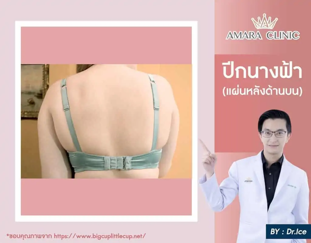 ดูดไขมัน เติมไขมัน Amara Liposuction Center (เอมาร่า คลินิก) โดยแพทย์ผู้มีประสบการณ์