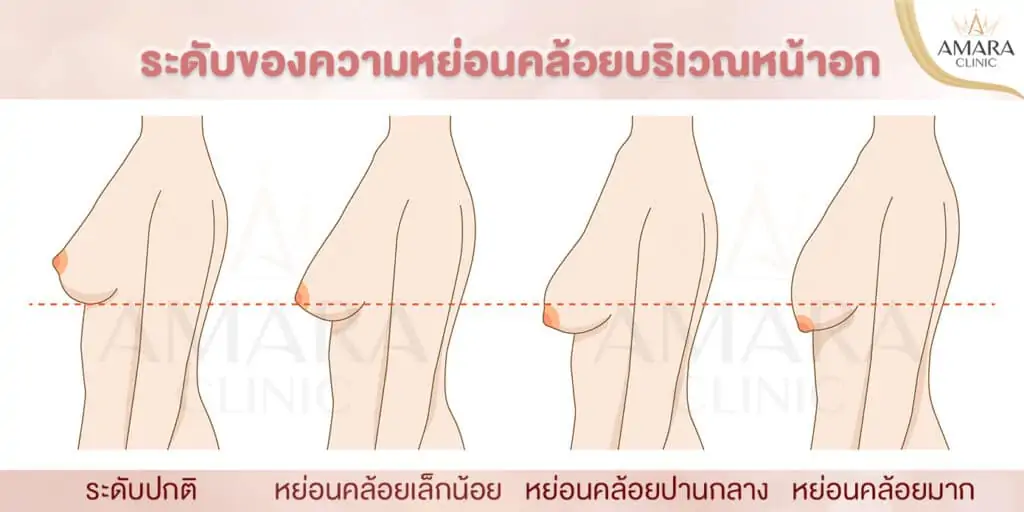 ดูดไขมัน เติมไขมัน Amara Liposuction Center (เอมาร่า คลินิก) โดยแพทย์ผู้มีประสบการณ์