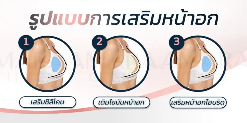 ทำนมดีไหม