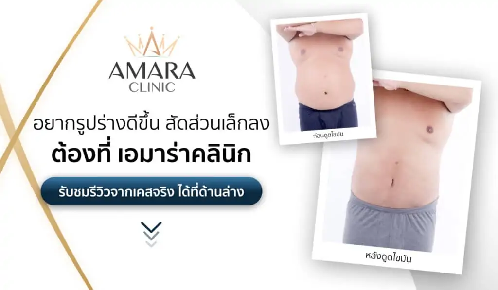 ดูดไขมัน เติมไขมัน Amara Liposuction Center (เอมาร่า คลินิก) โดยแพทย์ผู้มีประสบการณ์