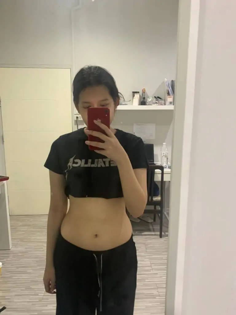 ดูดไขมัน เติมไขมัน Amara Liposuction Center (เอมาร่า คลินิก) โดยแพทย์ผู้มีประสบการณ์