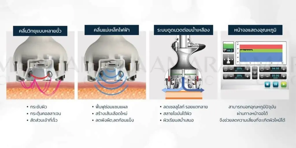 ดูดไขมัน เติมไขมัน Amara Liposuction Center (เอมาร่า คลินิก) โดยแพทย์ผู้มีประสบการณ์