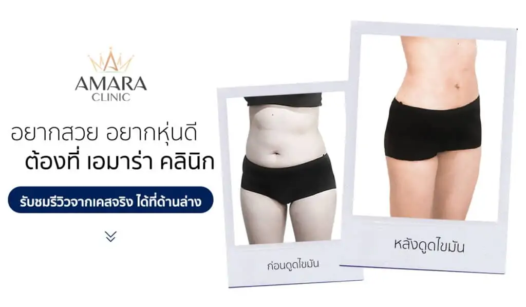 ดูดไขมัน เติมไขมัน Amara Liposuction Center (เอมาร่า คลินิก) โดยแพทย์ผู้มีประสบการณ์