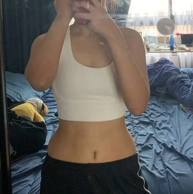 ดูดไขมัน เติมไขมัน Amara Liposuction Center (เอมาร่า คลินิก) โดยแพทย์ผู้มีประสบการณ์