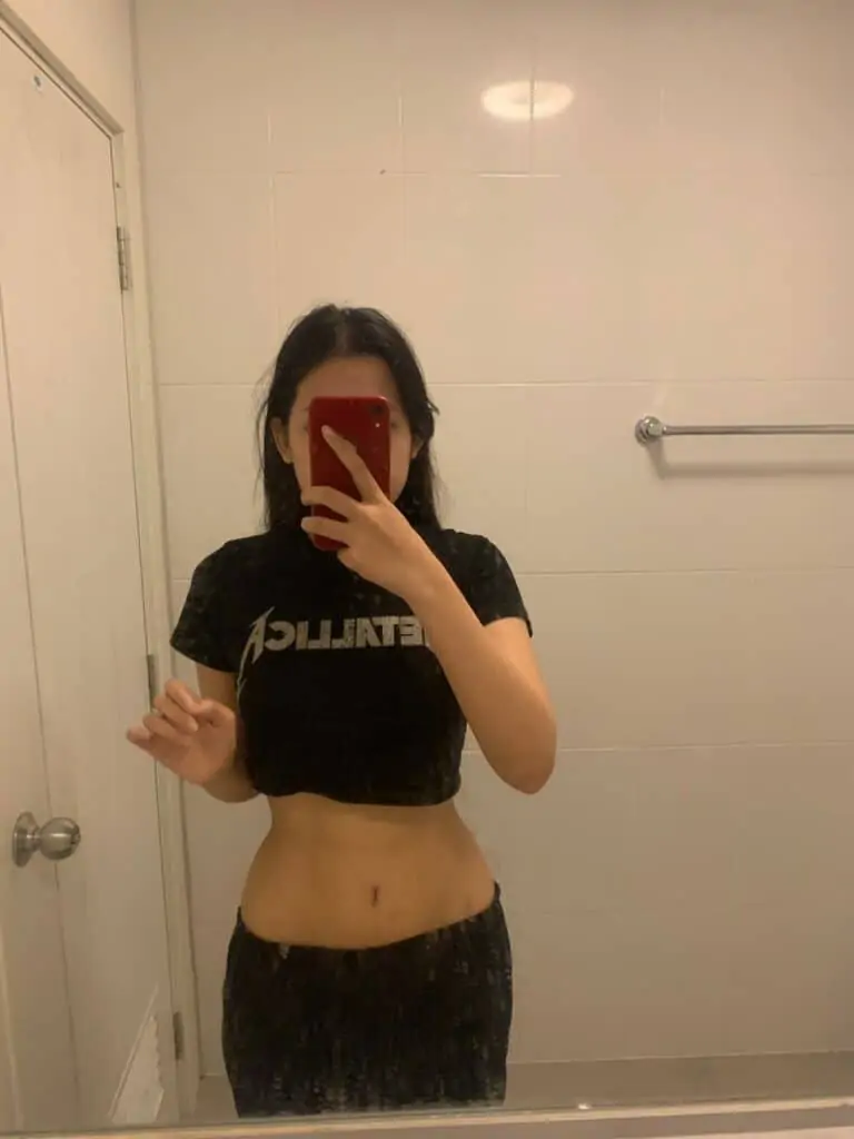 ดูดไขมัน เติมไขมัน Amara Liposuction Center (เอมาร่า คลินิก) โดยแพทย์ผู้มีประสบการณ์