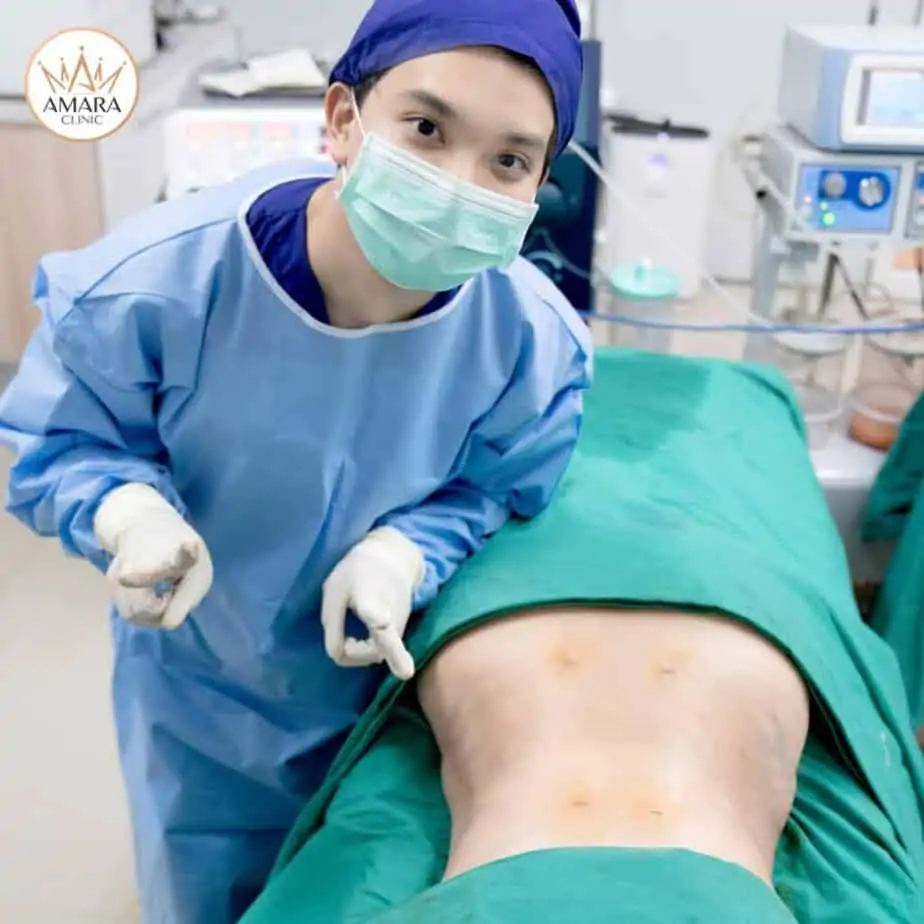 ดูดไขมัน เติมไขมัน Amara Liposuction Center (เอมาร่า คลินิก) โดยแพทย์ผู้มีประสบการณ์