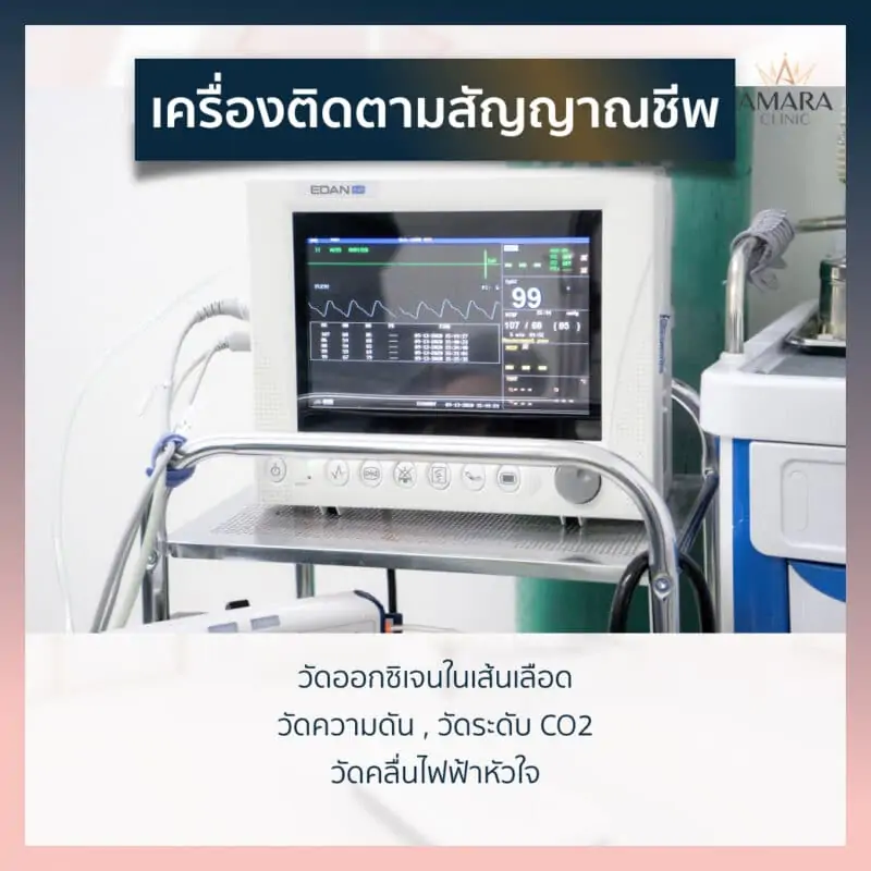 เครื่องติดตามสัญญาณชีพ