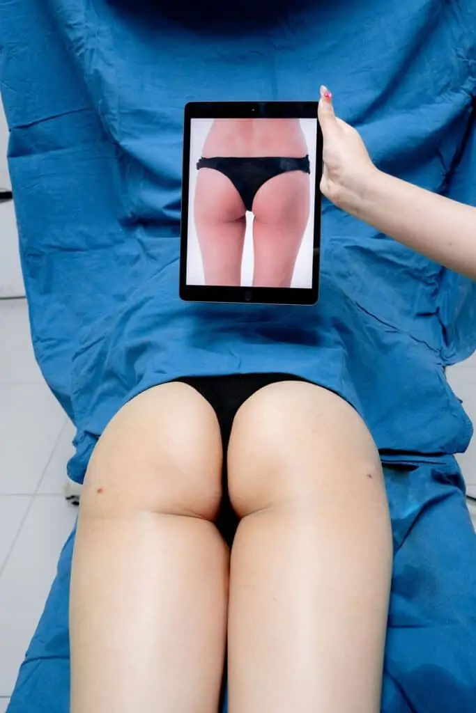 ดูดไขมัน เติมไขมัน Amara Liposuction Center (เอมาร่า คลินิก) โดยแพทย์ผู้มีประสบการณ์