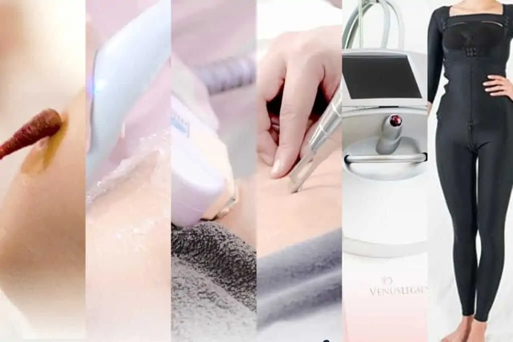 ดูดไขมัน เติมไขมัน Amara Liposuction Center (เอมาร่า คลินิก) โดยแพทย์ผู้มีประสบการณ์