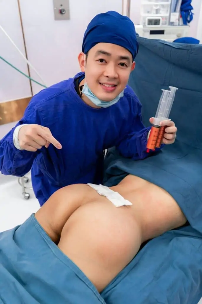 ดูดไขมัน เติมไขมัน Amara Liposuction Center (เอมาร่า คลินิก) โดยแพทย์ผู้มีประสบการณ์