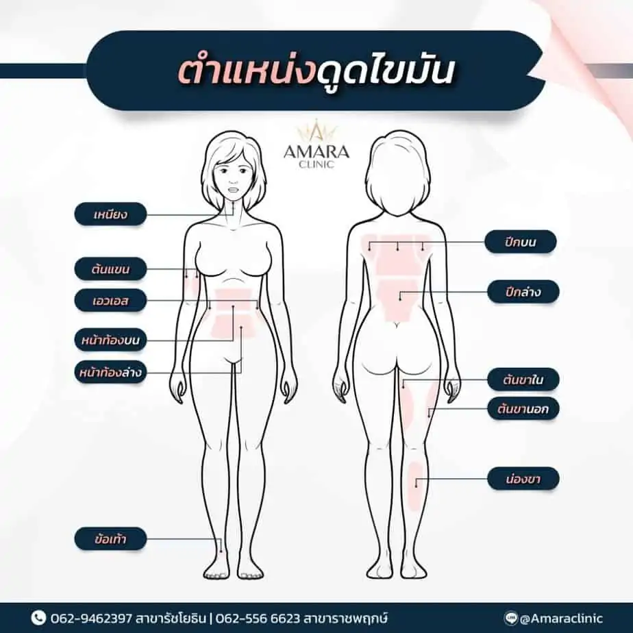 ดูดไขมัน เติมไขมัน Amara Liposuction Center (เอมาร่า คลินิก) โดยแพทย์ผู้มีประสบการณ์