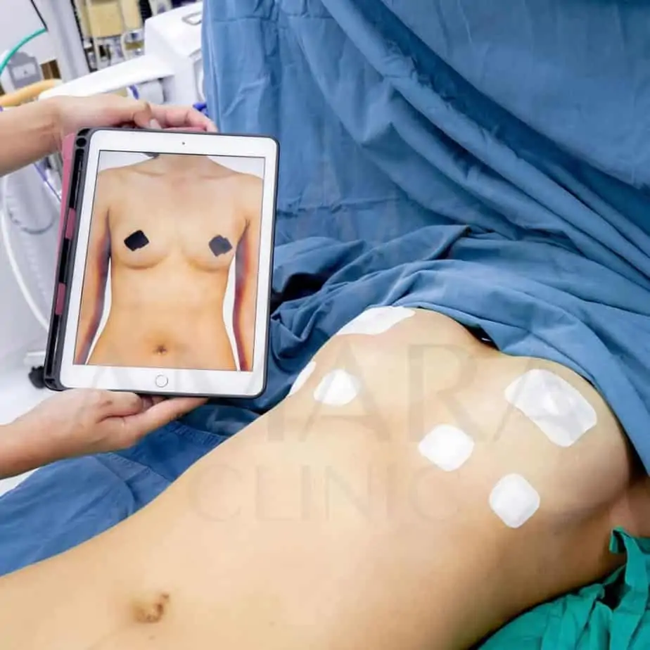 ดูดไขมัน เติมไขมัน Amara Liposuction Center (เอมาร่า คลินิก) โดยแพทย์ผู้มีประสบการณ์