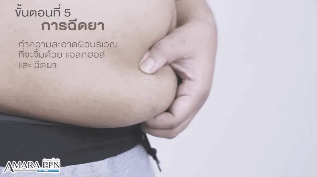 ดูดไขมัน เติมไขมัน Amara Liposuction Center (เอมาร่า คลินิก) โดยแพทย์ผู้มีประสบการณ์