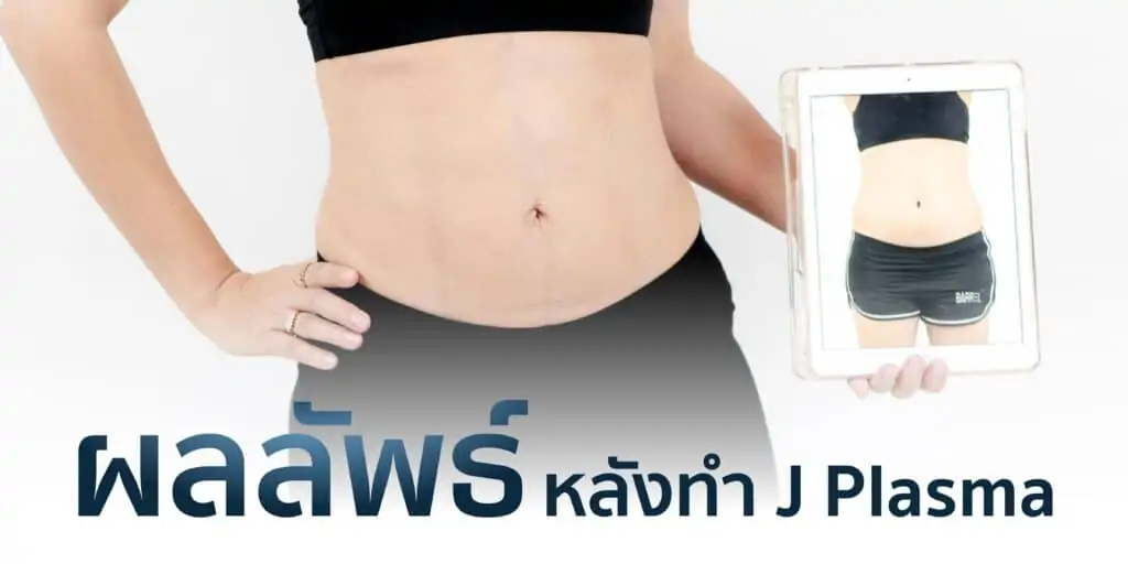 ดูดไขมัน เติมไขมัน Amara Liposuction Center (เอมาร่า คลินิก) โดยแพทย์ผู้มีประสบการณ์