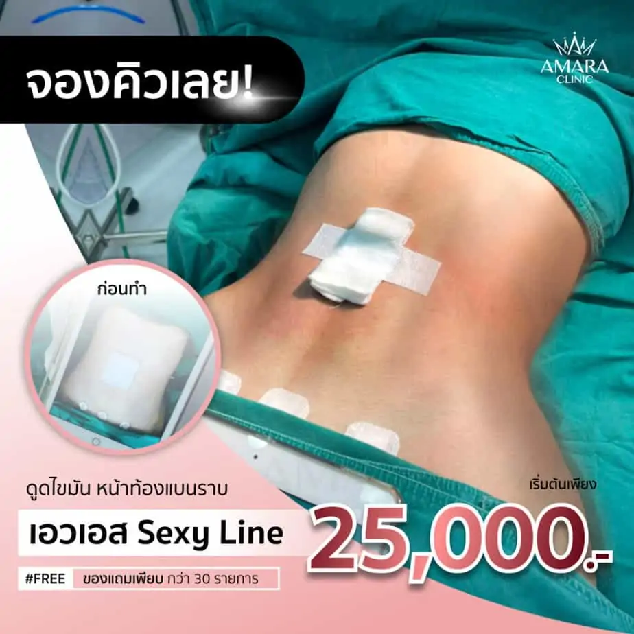 ดูดไขมัน เติมไขมัน Amara Liposuction Center (เอมาร่า คลินิก) โดยแพทย์ผู้มีประสบการณ์