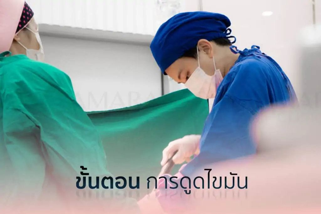 ดูดไขมัน เติมไขมัน Amara Liposuction Center (เอมาร่า คลินิก) โดยแพทย์ผู้มีประสบการณ์