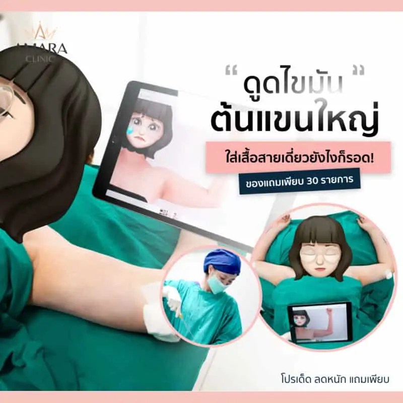 รีวิวดูดไขมันต้นแขน