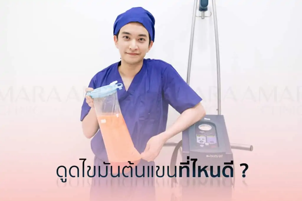 ดูดไขมัน เติมไขมัน Amara Liposuction Center (เอมาร่า คลินิก) โดยแพทย์ผู้มีประสบการณ์