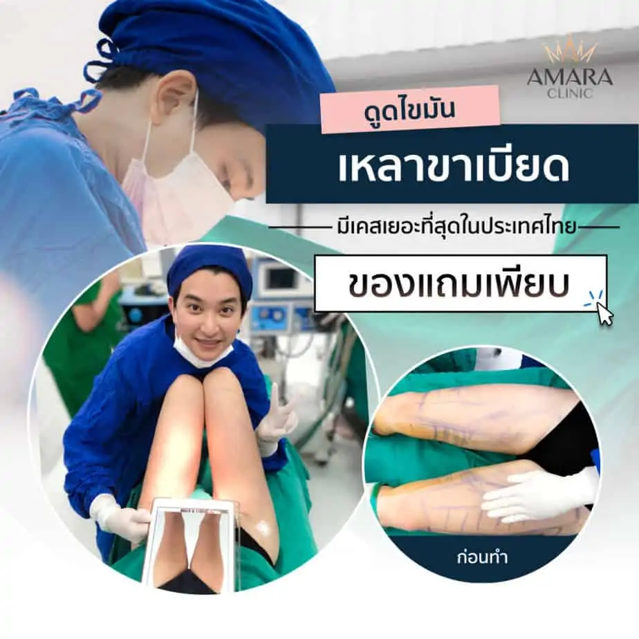 ดูดไขมัน เติมไขมัน Amara Liposuction Center (เอมาร่า คลินิก) โดยแพทย์ผู้มีประสบการณ์