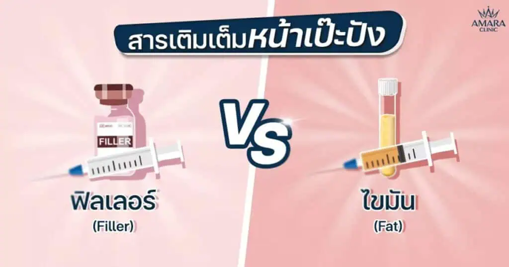 ฉีดไขมัน กับ ฉีดฟิลเลอร์