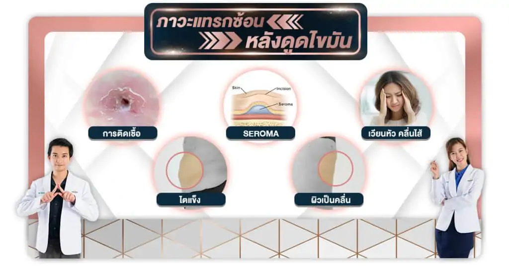 ดูดไขมัน เติมไขมัน Amara Liposuction Center (เอมาร่า คลินิก) โดยแพทย์ผู้มีประสบการณ์