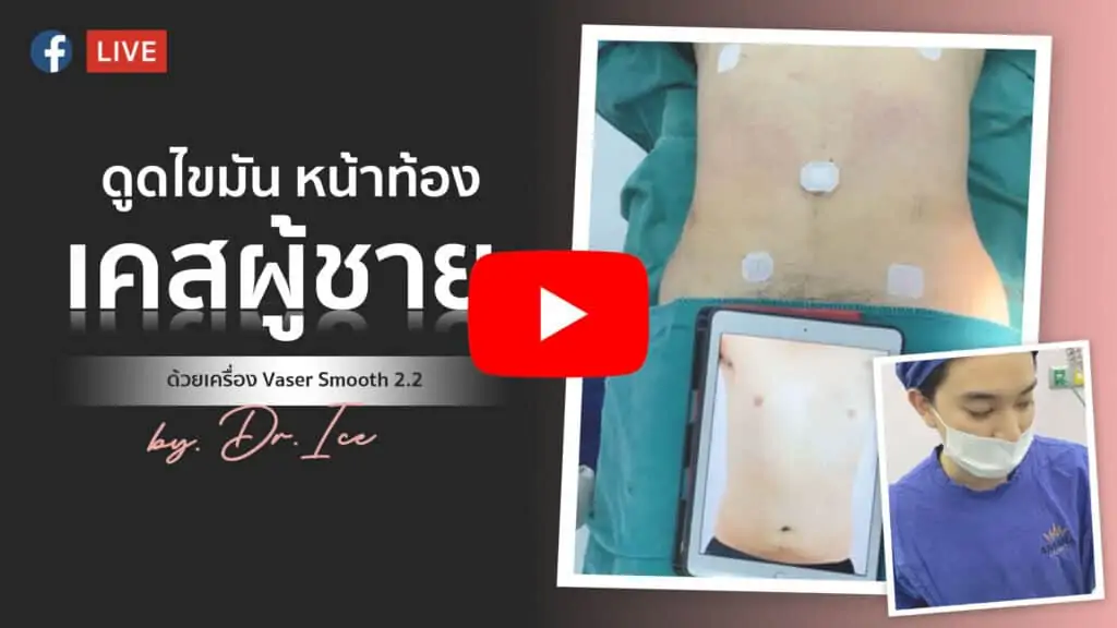 ดูดไขมัน เติมไขมัน Amara Liposuction Center (เอมาร่า คลินิก) โดยแพทย์ผู้มีประสบการณ์