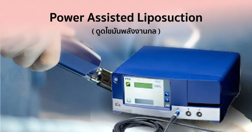 ดูดไขมัน เติมไขมัน Amara Liposuction Center (เอมาร่า คลินิก) โดยแพทย์ผู้มีประสบการณ์