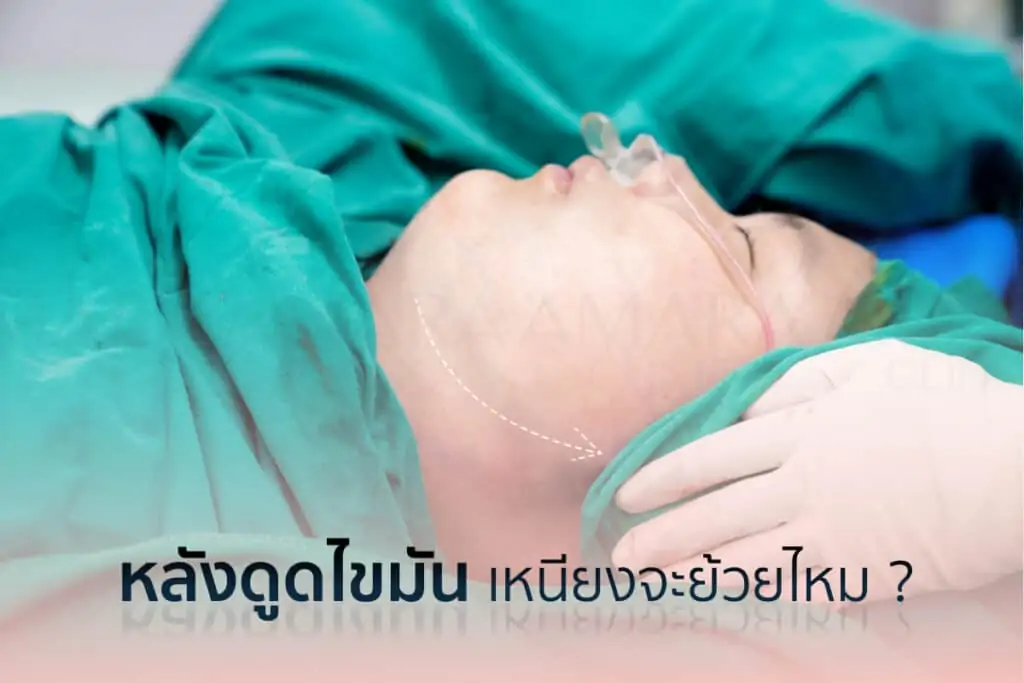ดูดไขมัน เติมไขมัน Amara Liposuction Center (เอมาร่า คลินิก) โดยแพทย์ผู้มีประสบการณ์
