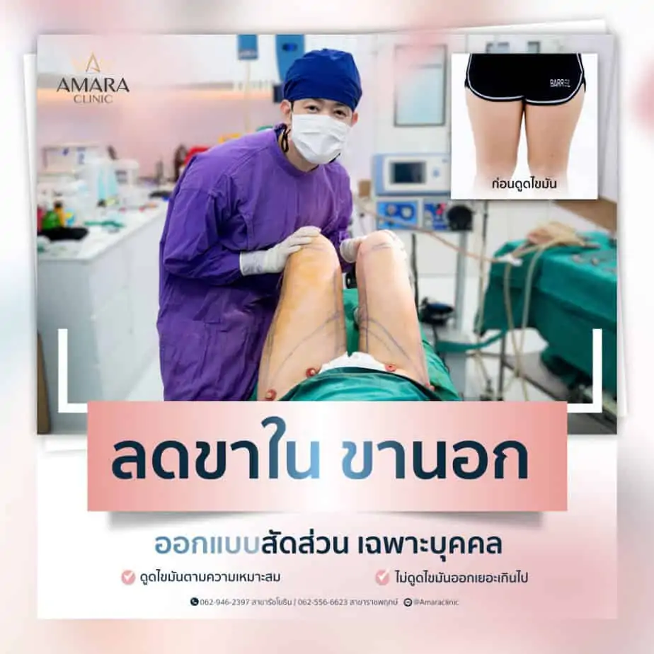 ดูดไขมัน เติมไขมัน Amara Liposuction Center (เอมาร่า คลินิก) โดยแพทย์ผู้มีประสบการณ์
