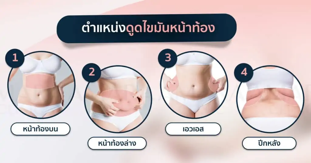 ดูดไขมัน เติมไขมัน Amara Liposuction Center (เอมาร่า คลินิก) โดยแพทย์ผู้มีประสบการณ์