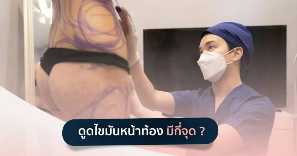 ดูดไขมัน เติมไขมัน Amara Liposuction Center (เอมาร่า คลินิก) โดยแพทย์ผู้มีประสบการณ์
