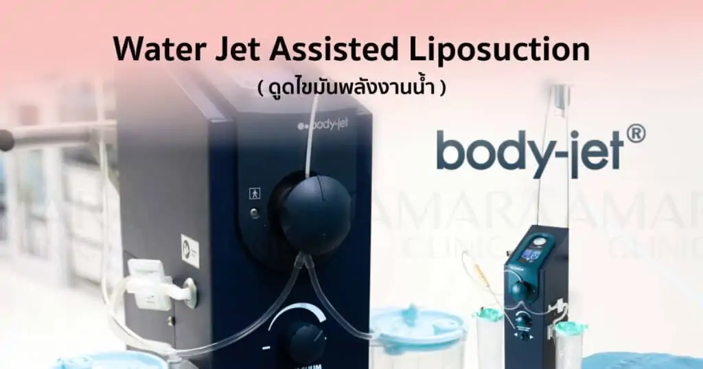 ดูดไขมัน เติมไขมัน Amara Liposuction Center (เอมาร่า คลินิก) โดยแพทย์ผู้มีประสบการณ์