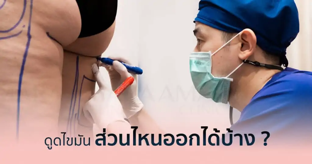 ดูดไขมัน เติมไขมัน Amara Liposuction Center (เอมาร่า คลินิก) โดยแพทย์ผู้มีประสบการณ์