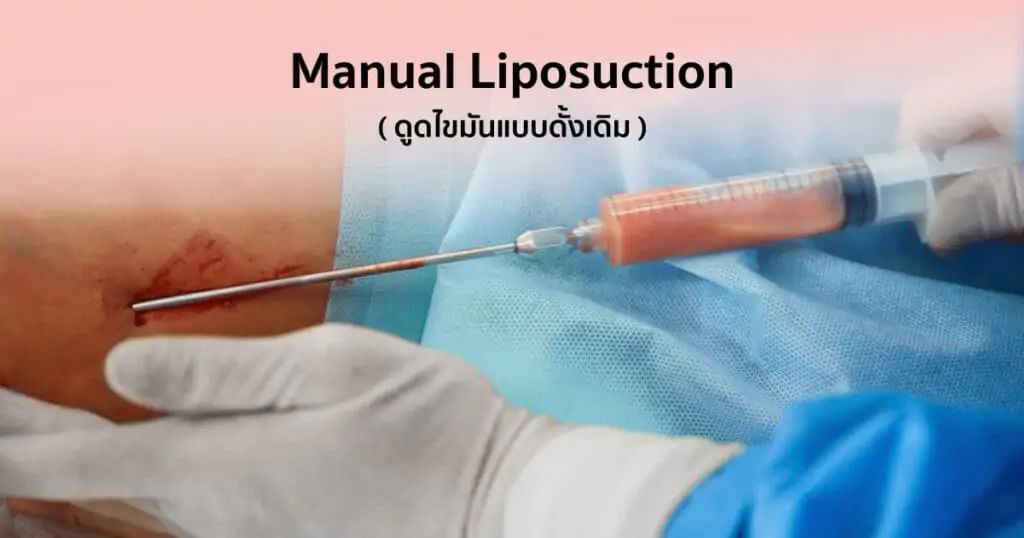 ดูดไขมัน เติมไขมัน Amara Liposuction Center (เอมาร่า คลินิก) โดยแพทย์ผู้มีประสบการณ์