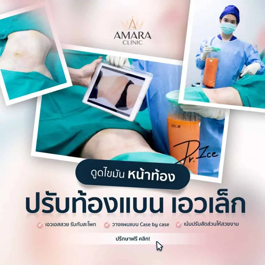ดูดไขมัน เติมไขมัน Amara Liposuction Center (เอมาร่า คลินิก) โดยแพทย์ผู้มีประสบการณ์