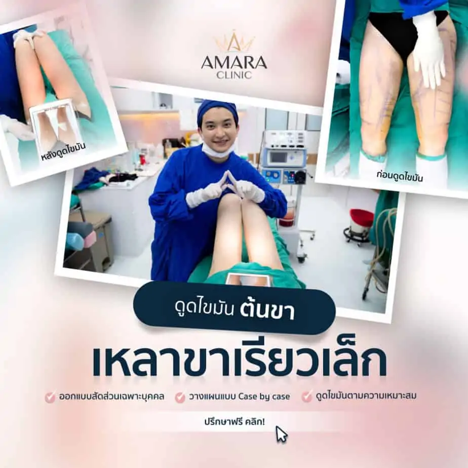 ดูดไขมัน เติมไขมัน Amara Liposuction Center (เอมาร่า คลินิก) โดยแพทย์ผู้มีประสบการณ์