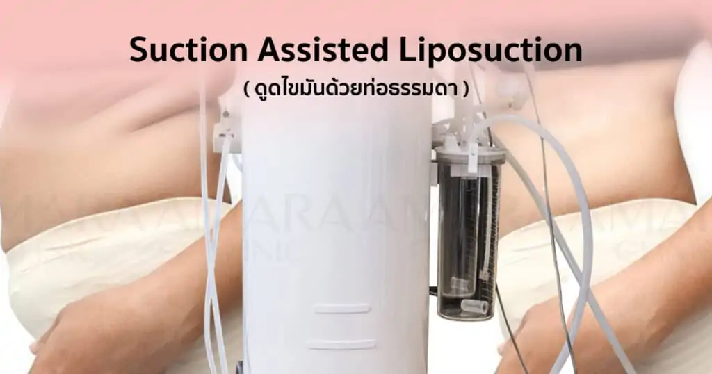 ดูดไขมัน เติมไขมัน Amara Liposuction Center (เอมาร่า คลินิก) โดยแพทย์ผู้มีประสบการณ์