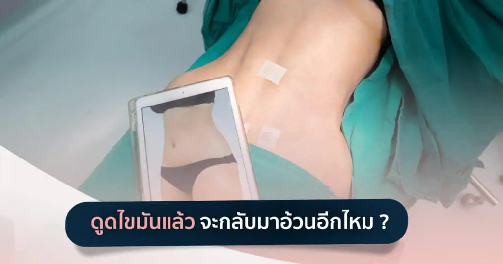 ดูดไขมัน เติมไขมัน Amara Liposuction Center (เอมาร่า คลินิก) โดยแพทย์ผู้มีประสบการณ์
