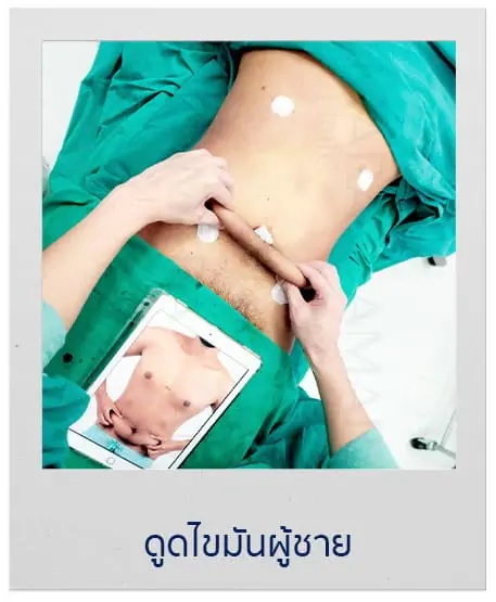 ดูดไขมัน เติมไขมัน Amara Liposuction Center (เอมาร่า คลินิก) โดยแพทย์ผู้มีประสบการณ์