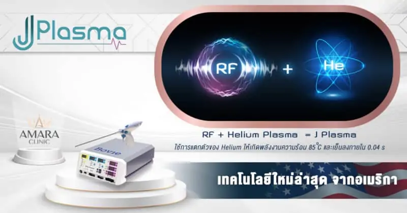 J Plasma คืออะไร