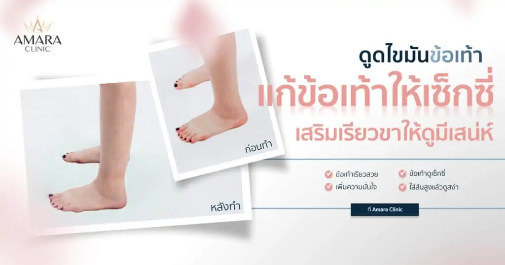 ดูดไขมัน เติมไขมัน Amara Liposuction Center (เอมาร่า คลินิก) โดยแพทย์ผู้มีประสบการณ์